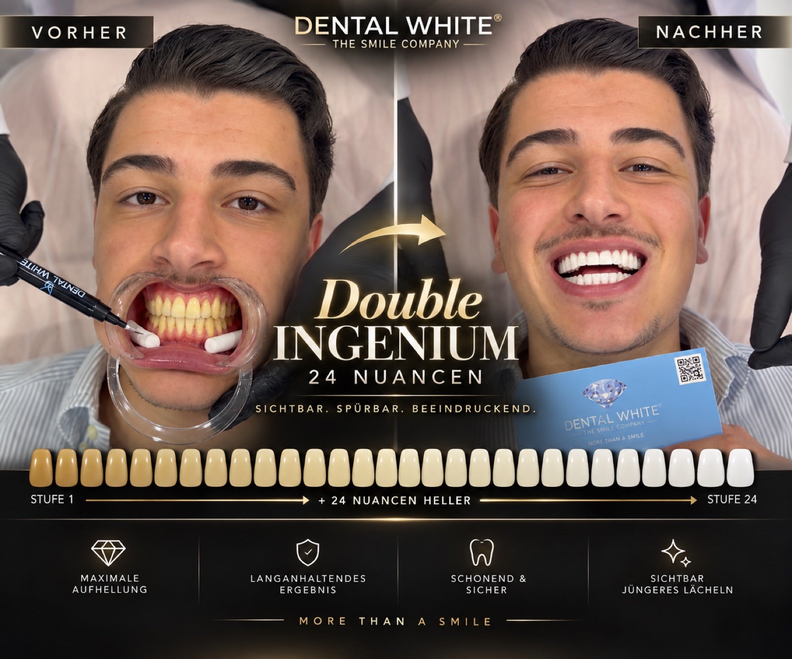 Double Ingenium Vorher Nachher — 24 Nuancen heller