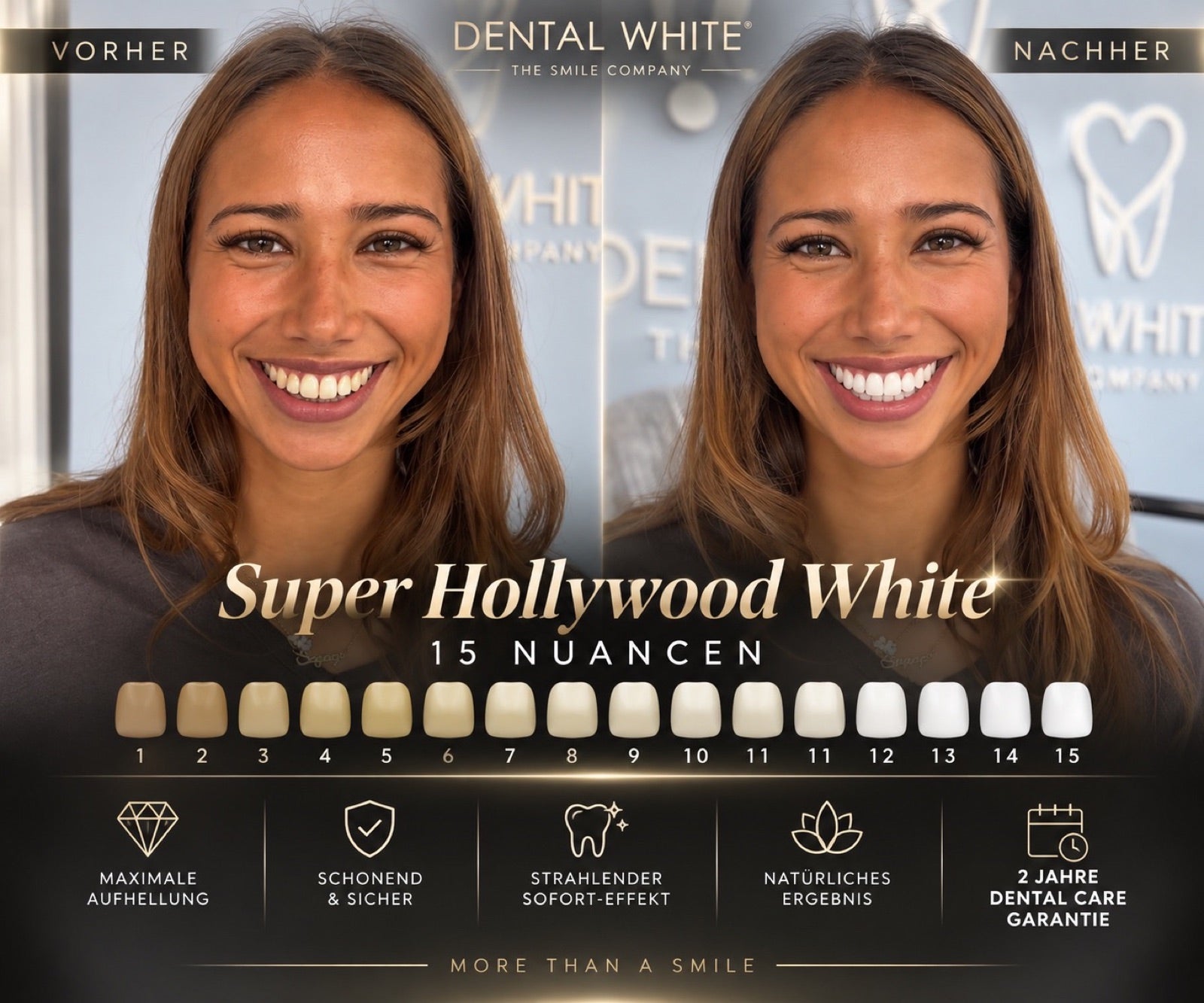 Super Hollywood White Vorher Nachher — 15 Nuancen heller